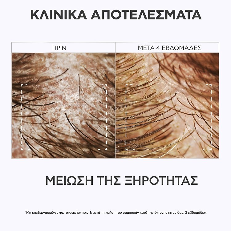 Apivita Dandruff Relief Scalp Lotion για το Ευαίσθητο τριχωτό 100ml
