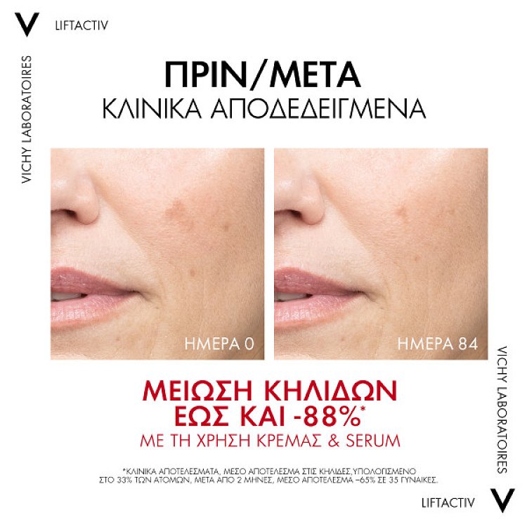 Vichy Liftactiv Pigment Specialist B3 SPF50 Κρέμα Προσώπου κατά των Κηλίδων 50ml