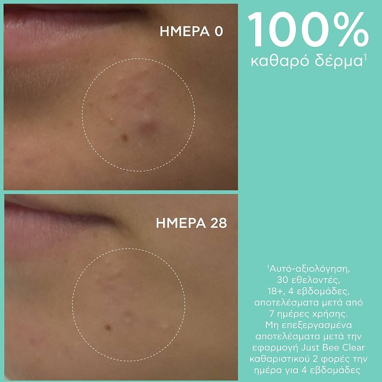 Apivita Just Bee Clear Καθαριστικό Gel με Propolis AmC & Φυτικό Σαλικυλικό Οξύ 200ml
