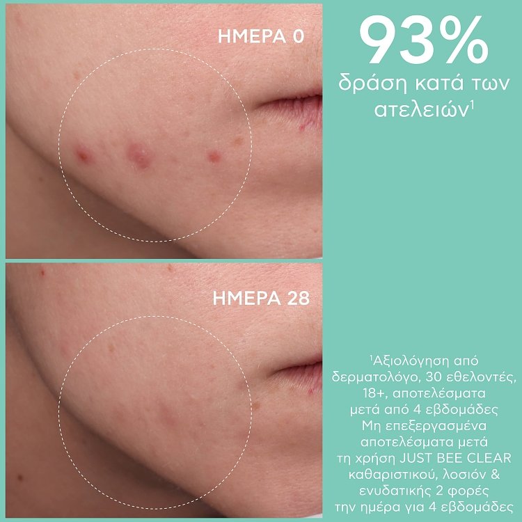 Apivita Just Bee Clear Λοσιόν  Σύσφιξης Πόρων με Propolis AmC & Φυτικό Σαλικυλικό Οξύ 200ml