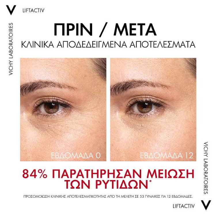 Vichy Liftactiv Collagen Specialist 16 Serum, Ενισχύει το κολλαγόνο και Διορθώνει 16 σημάδια γήρανσης 30ml