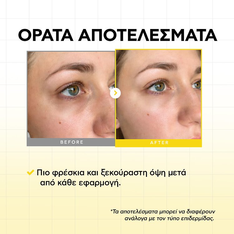 Natura Siberica Eye Patches Lab Biome με PDRN 1% για Αναγέννηση 60τμχ