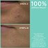 Apivita Just Bee Clear Καθαριστικό Gel με Propolis AmC & Φυτικό Σαλικυλικό Οξύ 200ml